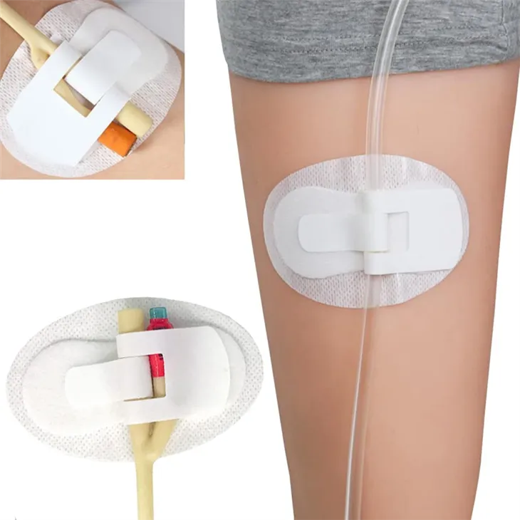 Urinary Catheter Securement Dressing