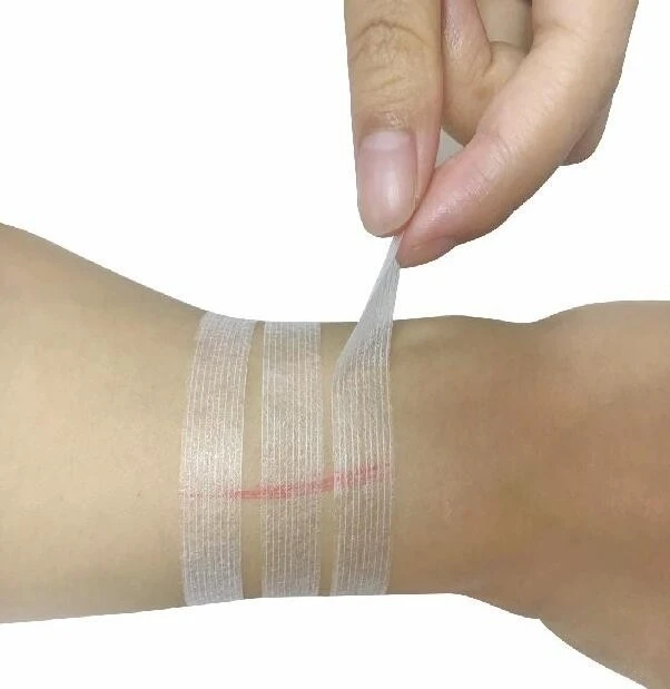 Sterile Stitch Strips